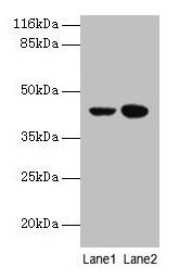 Western blot All lanes: CCR6 antibody at 10µg/ml Lane 1: MCF-7 whole cell lysate Lane 2: Hela whole cell lysate Secondary Goat polyclonal to rabbit IgG at 1/10000 dilution Predicted band size: 43 kDa Observed band size: 43 kDa