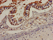 Immunohistochemistry analysis of human lung tissue using CSB-PA004846LA01HU at dilution of 1:100