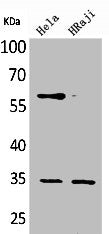 Western Blot analysis of HeLa Raji cells using CD32 Polyclonal Antibody