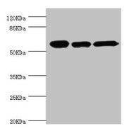 Western blot All lanes: CCT2 antibody at 5.63ug/ml Lane 1: Jurkat whole cell lysate Lane 2: NIH/3T3 whole cell lysate Lane 3: MCF-7 whole cell lysate Secondary Goat polyclonal to rabbit IgG at 1/10000 dilution Predicted band size: 58, 53 kDa Obser...