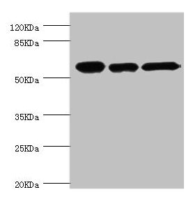 Western blot All lanes: CCT2 antibody at 5.63ug/ml Lane 1: Jurkat whole cell lysate Lane 2: NIH/3T3 whole cell lysate Lane 3: MCF-7 whole cell lysate Secondary Goat polyclonal to rabbit IgG at 1/10000 dilution Predicted band size: 58, 53 kDa Obser...