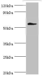 Western blot All lanes: T-complex protein 1 subunit gamma antibody at 12ug/ml + Mouse brain tissue Secondary Goat polyclonal to rabbit IgG at 1/10000 dilution Predicted band size: 61, 57 kDa Observed band size: 61 kDa