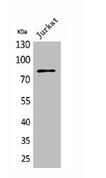 Western Blot analysis of Jurkat cells using PREP Polyclonal Antibody