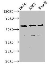 Western Blot Positive WB detected in: Hela whole cell lysate, K562 whole cell lysate, HepG2 whole cell lysate All lanes: CCT5 antibody at 4µg/ml Secondary Goat polyclonal to rabbit IgG at 1/50000 dilution Predicted band size: 60, 50 kDa Observed b...