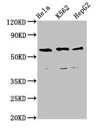 Western Blot Positive WB detected in: Hela whole cell lysate, K562 whole cell lysate, HepG2 whole cell lysate All lanes: CCT5 antibody at 4µg/ml Secondary Goat polyclonal to rabbit IgG at 1/50000 dilution Predicted band size: 60, 50 kDa Observed b...