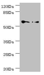 Western blot All lanes: CCT5 antibody at 1.78µg/ml Lane 1: Hela whole cell lysate Lane 2: Colo320 whole cell lysate Secondary Goat polyclonal to rabbit IgG at 1/10000 dilution Predicted band size: 60, 50 kDa Observed band size: 60 kDa