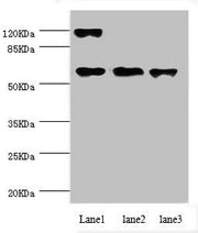Western blot All lanes: CCT5 antibody at 1.84ug/ml Lane 1: Hela whole cell lysate Lane 2: Colo320 whole cell lysate Lane 3: Mouse ovarian tissue Secondary Goat polyclonal to rabbit IgG at 1/10000 dilution Predicted band size: 60, 50 kDa Observed b...