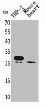 Western Blot analysis of THP-1 mouse heart cells using TREM-1 Polyclonal Antibody