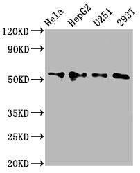 Western Blot Positive WB detected in: Hela whole cell lysate, HepG2 whole cell lysate, U251 whole cell lysate, 293T whole cell lysate All lanes: CCT6A antibody at 4.2µg/ml Secondary Goat polyclonal to rabbit IgG at 1/50000 dilution Predicted band...