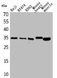 Western Blot analysis of Raji BT474 K562 mouse heart mouse skeletal muscle cells using Claudin-17 Polyclonal Antibody