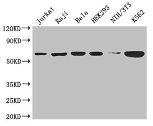 Western Blot Positive WB detected in: Jurkat whole cell lysate, Raji whole cell lysate, Hela whole cell lysate, HEK293 whole cell lysate, NIH/3T3 whole cell lysate, K562 whole cell lysate All lanes: CCT8 antibody at 3µg/ml Secondary Goat polyclona...