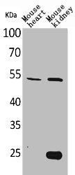 Western Blot analysis of mouse heart mouse kidney cells using Sg III Polyclonal Antibody