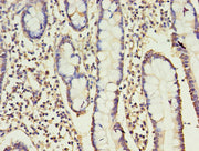 Immunohistochemistry of paraffin-embedded human small intestine tissue using CSB-PA004881EA01HU at dilution of 1:100