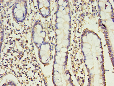 Immunohistochemistry of paraffin-embedded human small intestine tissue using CSB-PA004881EA01HU at dilution of 1:100