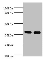 Western blot All lanes: CD1A antibody at 6ug/ml Lane 1: K562 whole cell lysate Lane 2: Mouse thymus tissue Secondary Goat polyclonal to rabbit IgG at 1/10000 dilution Predicted band size: 37 kDa Observed band size: 37 kDa