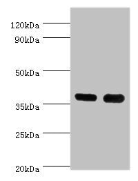 Western blot All lanes: CD1A antibody at 6ug/ml Lane 1: K562 whole cell lysate Lane 2: Mouse thymus tissue Secondary Goat polyclonal to rabbit IgG at 1/10000 dilution Predicted band size: 37 kDa Observed band size: 37 kDa