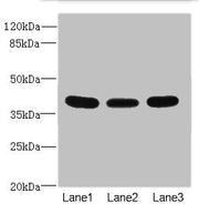 Western blot All lanes: CD1C antibody at 3.89ug/ml Lane 1: HepG2 whole cell lysate Lane 2: A549 whole cell lysate Lane 3: MCF-7 whole cell lysate Secondary Goat polyclonal to rabbit IgG at 1/10000 dilution Predicted band size: 38 kDa Observed band...