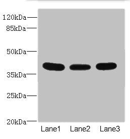 Western blot All lanes: CD1C antibody at 3.89ug/ml Lane 1: HepG2 whole cell lysate Lane 2: A549 whole cell lysate Lane 3: MCF-7 whole cell lysate Secondary Goat polyclonal to rabbit IgG at 1/10000 dilution Predicted band size: 38 kDa Observed band...
