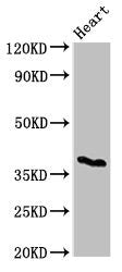 Western Blot Positive WB detected in: Mouse heart tissue All lanes: CD1C antibody at 3ug/ml Secondary Goat polyclonal to rabbit IgG at 1/50000 dilution Predicted band size: 38 kDa Observed band size: 38 kDa