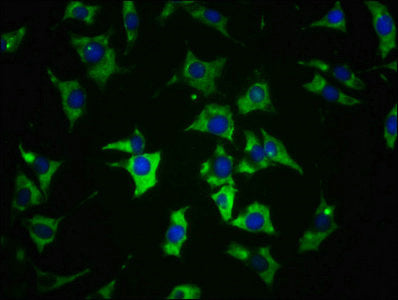 Immunofluorescence staining of SH-SY5Y cells with CSB-PA004895EA01HU at 1:100, counter-stained with DAPI. The cells were fixed in 4% formaldehyde, permeabilized using 0.2% Triton X-100 and blocked in 10% normal Goat Serum. The cells were then incu...