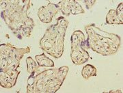 Immunohistochemistry of paraffin-embedded human placenta tissue using CSB-PA004895ESR1HU at dilution of 1:100