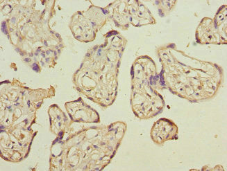 Immunohistochemistry of paraffin-embedded human placenta tissue using CSB-PA004895ESR1HU at dilution of 1:100