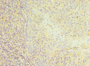 Immunohistochemistry of paraffin-embedded human tonsil tissue using CSB-PA004900ESR1HU at dilution of 1:100