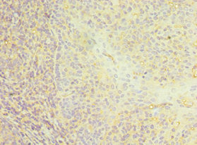 Immunohistochemistry of paraffin-embedded human tonsil tissue using CSB-PA004900ESR1HU at dilution of 1:100
