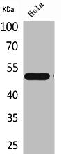 Western Blot analysis of HeLa cells using LXRα Polyclonal Antibody
