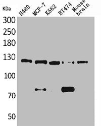 Western Blot analysis of H460 MCF7 K562 BT474 mouse brain cells using CD56 Polyclonal Antibody