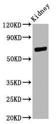 Western Blot Positive WB detected in: Rat kidney tissue All lanes: CD2AP antibody at 11ug/ml Secondary Goat polyclonal to rabbit IgG at 1/50000 dilution Predicted band size: 72 kDa Observed band size: 72 kDa