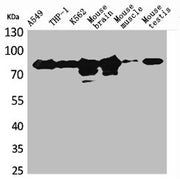 Western Blot analysis of A549 THP-1 K562 mouse brain mouse skeletal muscle mouse testis cells using PKC γ Polyclonal Antibody