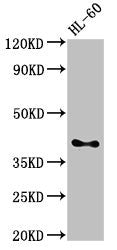 Western Blot Positive WB detected in: HL60 whole cell lysate All lanes: CD33 antibody at 3µg/ml Secondary Goat polyclonal to rabbit IgG at 1/50000 dilution Predicted band size: 40, 34, 26 kDa Observed band size: 40 kDa
