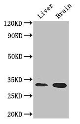 Western Blot Positive WB detected in: Mouse liver tissue, Mouse brain tissue All lanes: CD37 antibody at 2.7ug/ml Secondary Goat polyclonal to rabbit IgG at 1/50000 dilution Predicted band size: 32, 24, 23 kDa Observed band size: 32 kDa