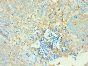 Immunohistochemistry of paraffin-embedded human tonsil tissue using CSB-PA004929ESR1HU at dilution of 1:100