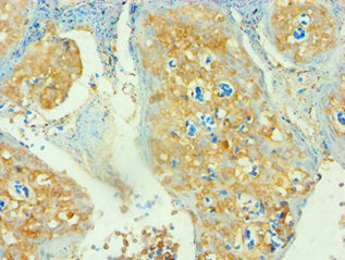 Immunohistochemistry of paraffin-embedded human tonsil tissue using CSB-PA004930ESR1HU at dilution of 1: 100