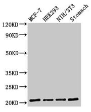 Western Blot Positive WB detected in: MCF-7 whole cell lysate, HEK293 whole cell lysate, NIH/3T3 whole cell lysate, Rat stomach tissue All lanes: CD3G antibody at 2µg/ml Secondary Goat polyclonal to rabbit IgG at 1/50000 dilution Predicted band si...