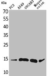 Western Blot analysis of PC-3 A549 OVCAR3 mouse colon cells using Eotaxin-3 Polyclonal Antibody