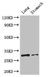 Western Blot Positive WB detected in: Mouse lung tissue, Mouse stomach tissue All lanes: TNFRSF5 antibody at 3.2ug/ml Secondary Goat polyclonal to rabbit IgG at 1/50000 dilution Predicted band size: 31, 23 kDa Observed band size: 31 kDa