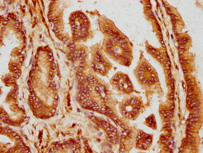 IHC image of CSB-PA004940LA01HU diluted at 1:300 and staining in paraffin-embedded human prostate tissue performed on a Leica BondTM system. After dewaxing and hydration, antigen retrieval was mediated by high pressure in a citrate buffer (pH 6.0)...