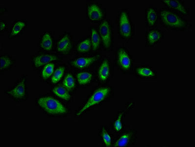 Immunofluorescent analysis of A549 cells using CSB-PA004942LA01HU at dilution of 1:100 and Alexa Fluor 488-congugated AffiniPure Goat Anti-Rabbit IgG(H+L)