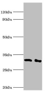 Western blot All lanes: Lymphocyte function-associated antigen 3 antibody at 2ug/ml Lane 1: Hela whole cell lysate Lane 2: Jurkat whole cell lysate Secondary Goat polyclonal to rabbit IgG at 1/10000 dilution Predicted band size: 29, 27, 28 kDa Obs...