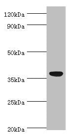 Western blot All lanes: CD5L antibody at 3ug/ml + A431 whole cell lysate Secondary Goat polyclonal to rabbit IgG at 1/10000 dilution Predicted band size: 38 kDa Observed band size: 38 kDa