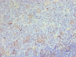 Immunohistochemistry of paraffin-embedded human tonsil tissue using CSB-PA004951ESR2HU at dilution of 1:100