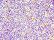 Immunohistochemistry of paraffin-embedded human tonsil tissue using CSB-PA004953ESR1HU at dilution of 1:100