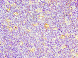 Immunohistochemistry of paraffin-embedded human tonsil tissue using CSB-PA004953ESR1HU at dilution of 1:100