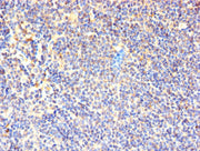 Immunohistochemistry of paraffin-embedded human lymphoid tissue using CSB-PA004953YA01HU at dilution of 1:100