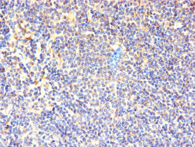Immunohistochemistry of paraffin-embedded human lymphoid tissue using CSB-PA004953YA01HU at dilution of 1:100