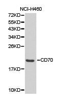 Western blot analysis of extracts of NCI-H460 cell lines, using CD70 antibody.