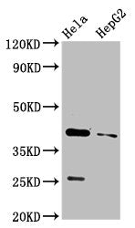 Western Blot Positive WB detected in: Hela whole cell lysate, HepG2 whole cell lysate All lanes: CD72 antibody at 3.2µg/ml Secondary Goat polyclonal to rabbit IgG at 1/50000 dilution Predicted band size: 41 kDa Observed band size: 41 kDa